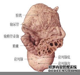 前列腺增生